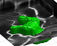 Automatische 3D Segmentierung von Zellen