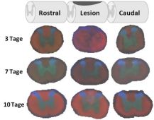 Bild des Projekts 3D-MALDI-Imaging einer Rckenmarksverletzung bei der Ratte