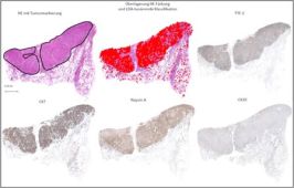 Bild des Projekts Entwicklung eines Digital-Staining-Verfahrens als pathologisch-histologisches Diagnosewerkzeug auf Basis der MALDI-Imaging-Technologie