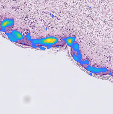 Bild des Projekts SPAplus: Small Data Probleme in der digitalen Pathologie und programmbegleitende Maßnahmen