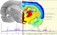 Bild des Projekts Räumlich dreidimensional aufgelöste Stoffwechsel-Analyse für die Medizin