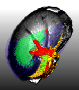 Logo Projekt BMBF-MALDI AMK: 3D-MALDI-Imaging zur Analyse proteomischer Marker und klinischer Wirkstofffverteilung