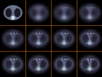 spect-img2